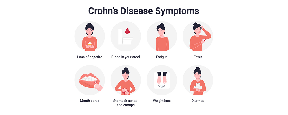 crohn's disease symptoms