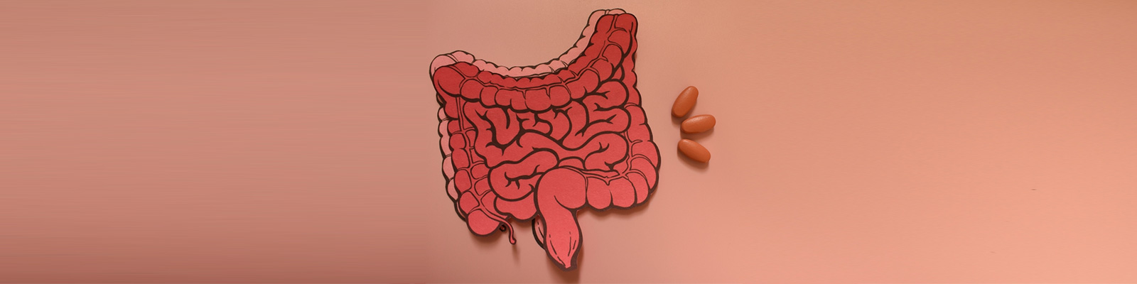 Crohn’s Disease and Life Expectancy: How Vicious It Can Be?
