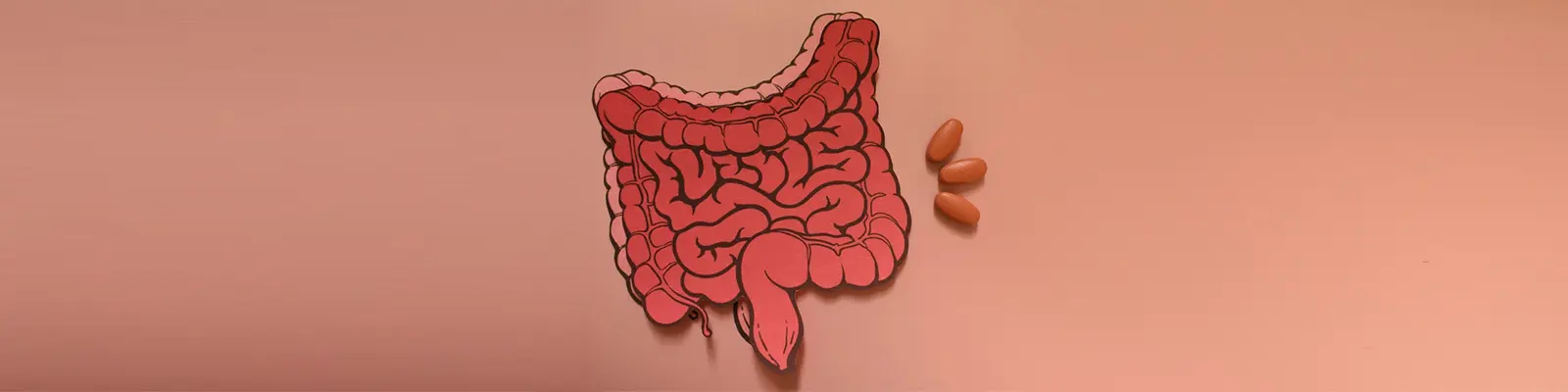 Crohn’s Disease and Life Expectancy: How Vicious It Can Be?