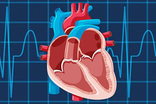 Supraventricular Tachycardia Self-Care
